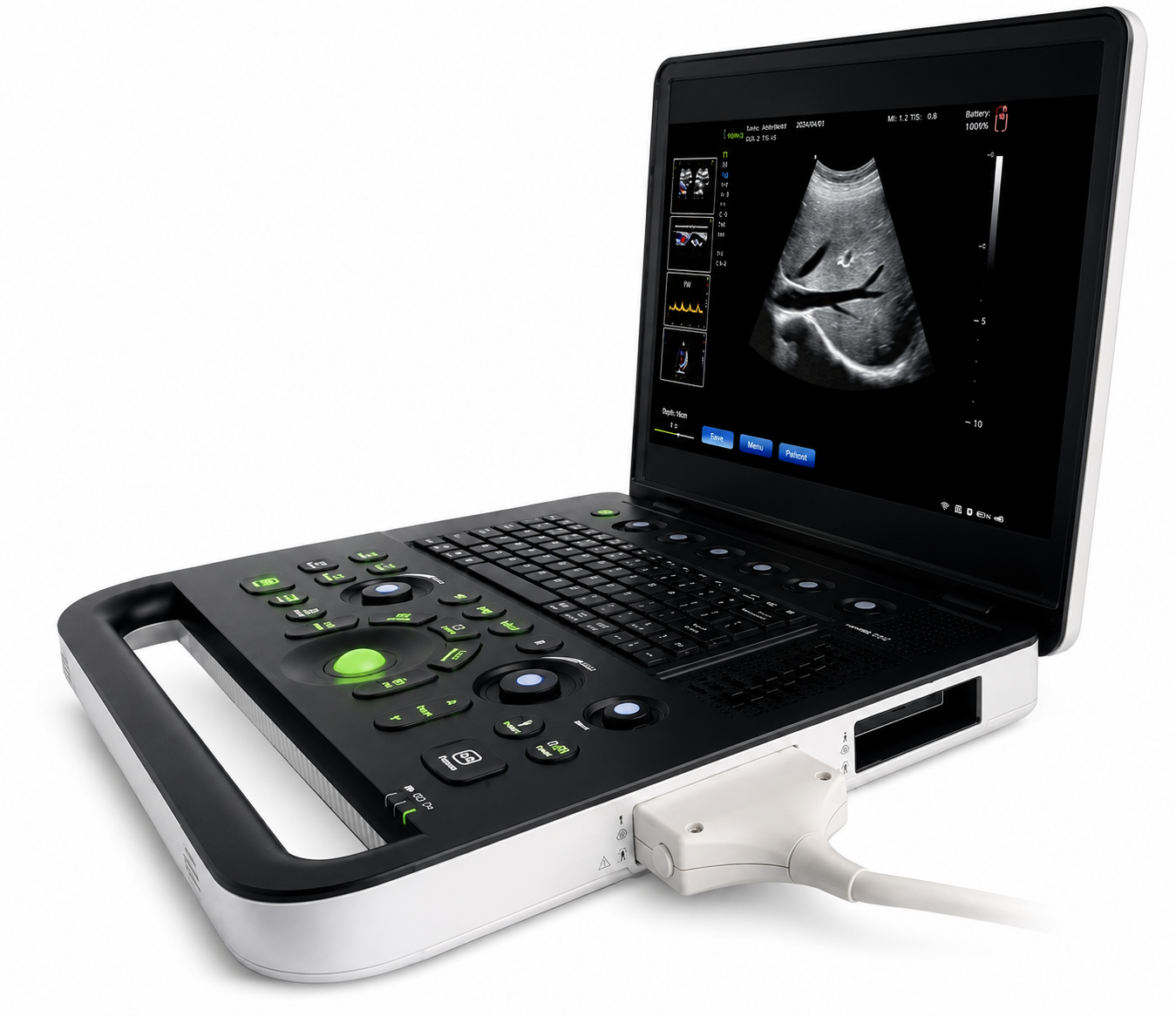 VET-SN50 Vet Ultrasound (with 3.5 MHz Convex Probe)